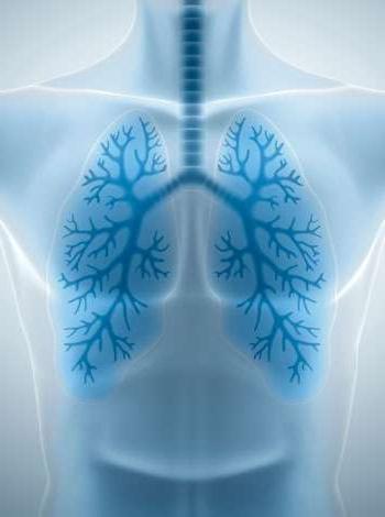 Lung Scan X-Ray Image